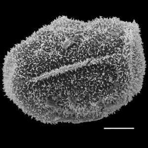 Spore of a fern from Paraguay (Lastreopsis amplissima). Single line across center is the germination furrow. White bar = 10 micrometers.