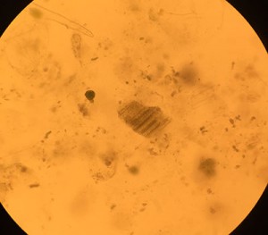 Algae slide spirulina