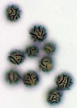 amoespor.jpg - 13041 Bytes