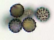 amyloid basidiospores