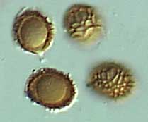 floccopusspores.jpg - 10946 Bytes