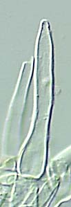 pileocystidium