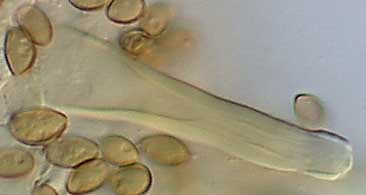 basisidiospores and cystidia