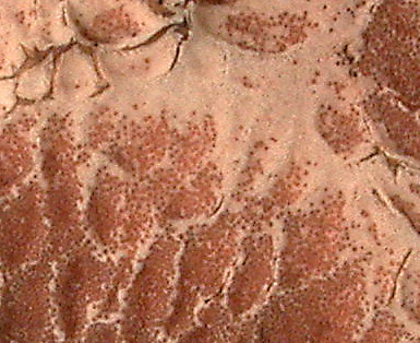Closeup of perithecia