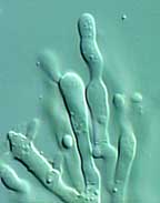 oligocheilo.jpg - 10049 Bytes