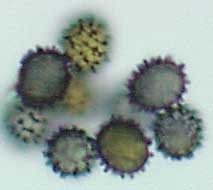 amyloid basidiospores