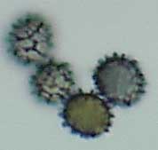 amyloid basidiospores