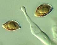 spores and cheilocystidium