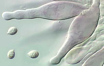 basidiospores & hymenial cystidia