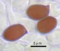 turpisspores3.jpg - 9656 Bytes