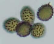 amyloid basidiospores